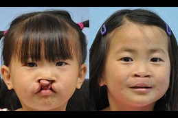 أفضل العيوب الخلقية في دبي