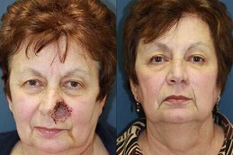 أفضل عيادة الحروق الترميمية في دبي