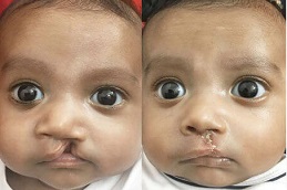 أفضل عيادة للتشوهات الخلقية في دبي وأبو ظبي