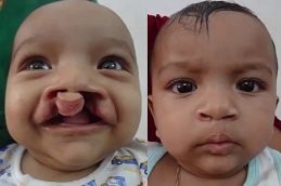 أفضل عيادة للتشوهات الخلقية في دبي