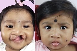 عيادة التشوهات الخلقية بأبوظبي