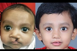 عيادة التشوهات الخلقية في دبي وأبو ظبي