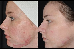 عيادة الحروق الترميمية في أبو ظبي