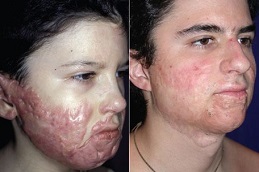 عيادة الحروق الترميمية في دبي وأبو ظبي