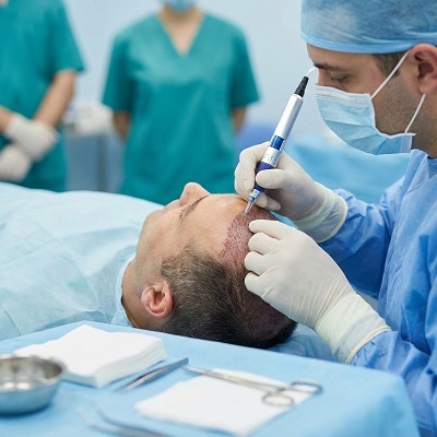 تكلفة زراعة الشعر بتقنية DHI في دبي