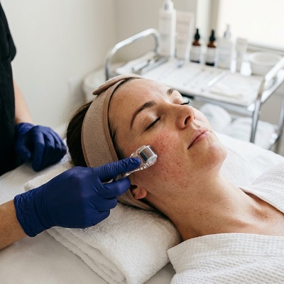 علاج الديرما رولر في دبي وأبوظبي – للرجال والنساء