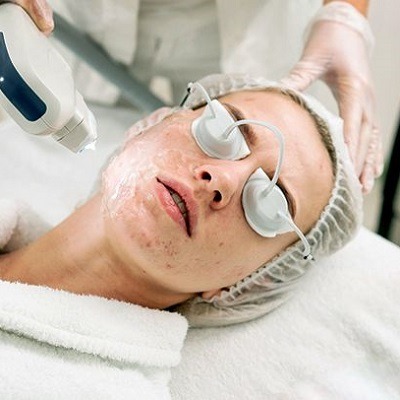 Laser Treatment For Acne Scars Cost in Dubai & Abu Dhabi Cost