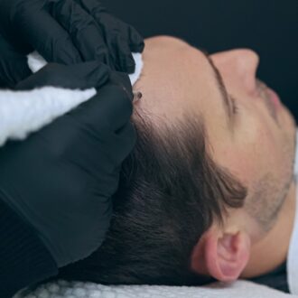 Cost of GFC Hair Treatment in Dubai