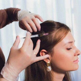 Acell & PRP Injections for Hair Loss in Dubai