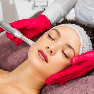 Benefits of Microneedling