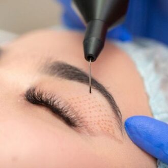 Plasma Fibroblast Therapy in Dubai