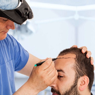 Best Hair Transplant Treatments in Dubai 2025