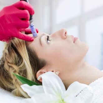 Microneedling with PRP Treatment in Dubai