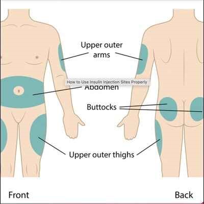 glutathione and mounjaro Mounjaro injections in Islamabad, Rawalpindi & Pakistan main image 0