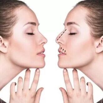 How Much Does Rhinoplasty Cost in Dubai