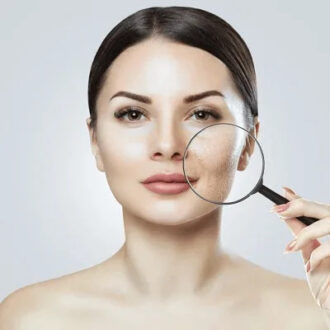 How To Remove Pigmentation From Face Permanently