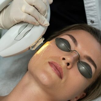 Best Laser Treatment for Rosacea in Dubai: Safe & Effective Solutions